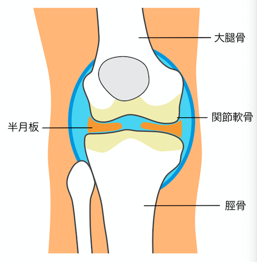 膝関節症状のイラスト